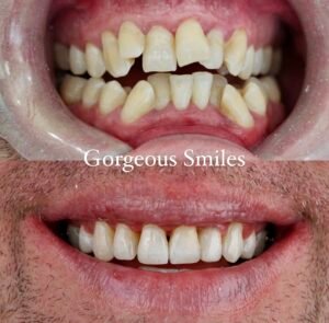 Dentiste Alger Odf Alger